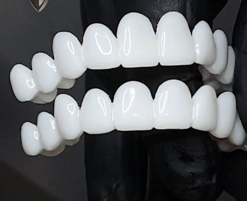 Anpassbare Zahnprothese mit Zahnlinsen