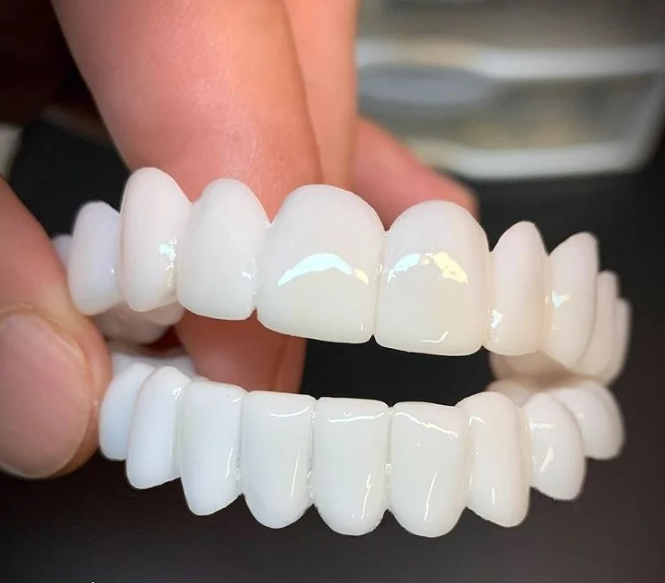 Smile Lens – Justerbar hvit tannprotese for umiddelbar smilkorreksjon | Luvikno