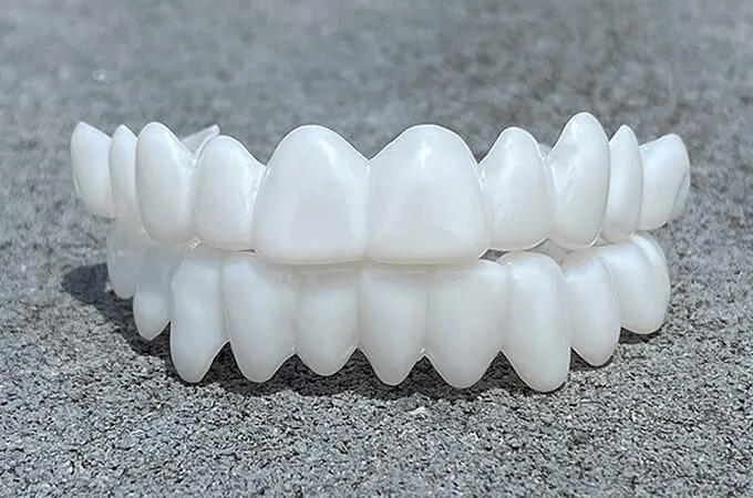 Smile Lens – Justerbar hvit tannprotese for umiddelbar smilkorreksjon | Luvikno