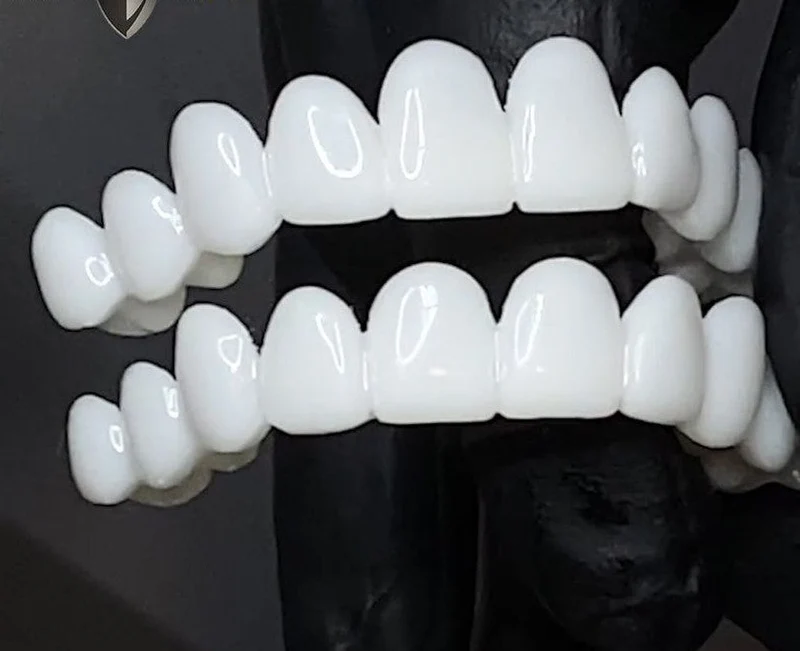 Kosmetiske Tann Toppers SmileShape – Gjenbrukbar, Fleksibel og Naturlig Hvit | Luvikno